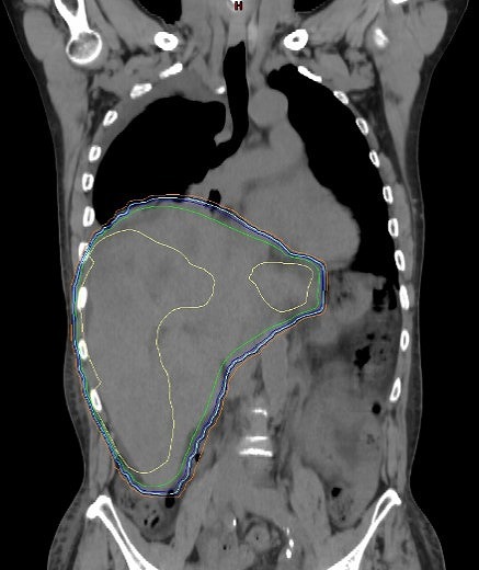 tenikansyuyou tankai.jpg