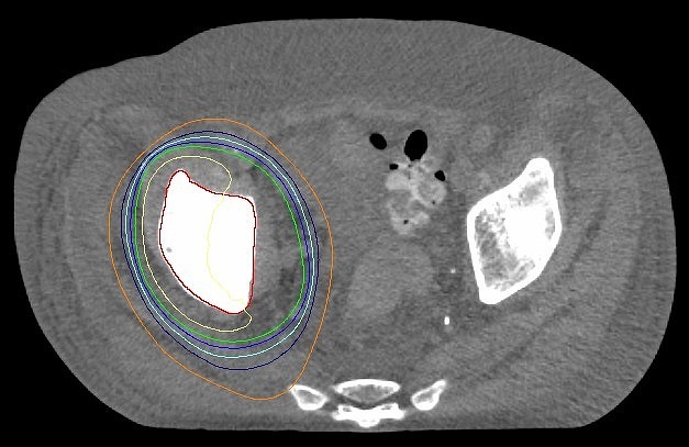 tenikotusyuyou tankai.jpg