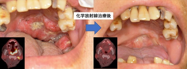 toukeibu tyuuintougan.jpg