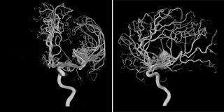 3DRA_160X320_.jpg