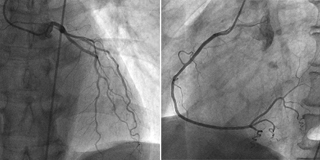 Cardiac_160X320_.jpg