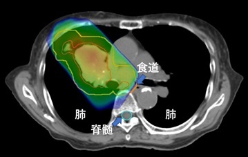 radiologyc_pic04.jpg