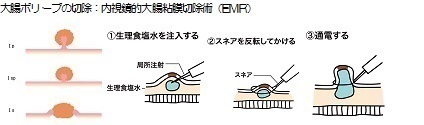 emr.jpg