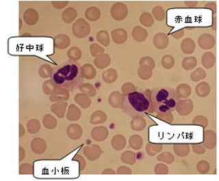 血液像（白血球分画）検査